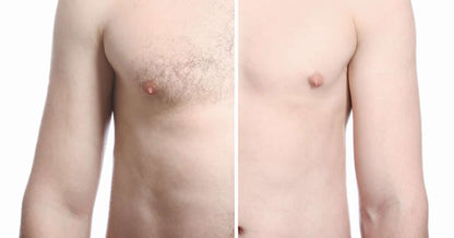 TIRAS Depilación Corporal caja x 20 unidades