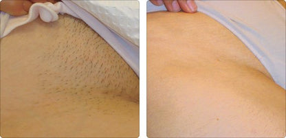 TIRAS Depilación Corporal caja x 20 unidades