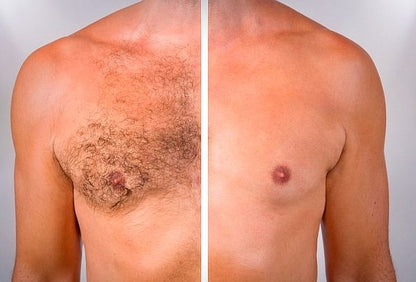 TIRAS Depilación Corporal caja x 20 unidades